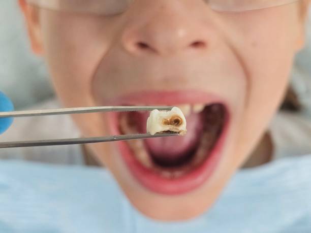 Best Emergency Treatment for Oral Infections in Holiday Heights, NJ
